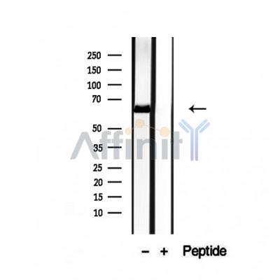 NR1D1 Antibody - Western blot analysis of extracts from MCF-7 cells, using NR1D1 antibody.