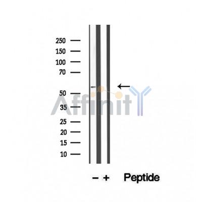 WSB1 Antibody - Western blot analysis of extracts from COLO 320 cells, using WSB1 antibody.