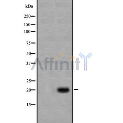Cleaved-Caspase 1 (Asp296), p20 Antibody - Western blot analysis of Cleaved Caspase-1 (Asp296) using Jurkat whole cell lysates.