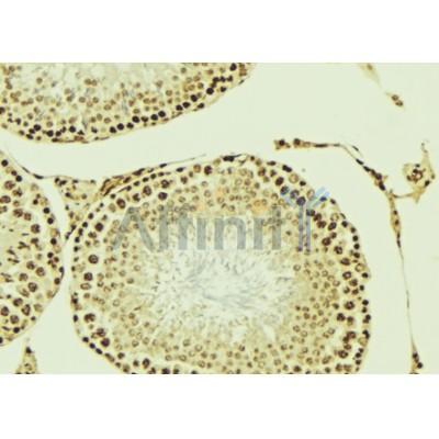 AF10 Antibody - DF3216 at 1/100 staining human Testis tissue sections by IHC-P.