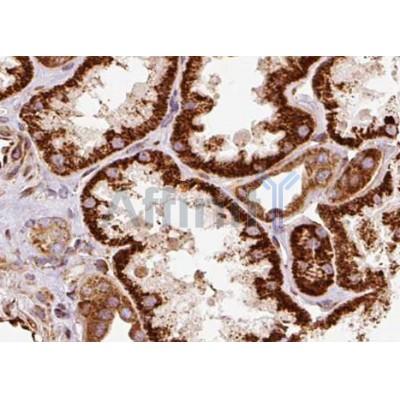 AQP1 Antibody - AF5231 at 1/100 staining human kidney tissue sections by IHC-P.