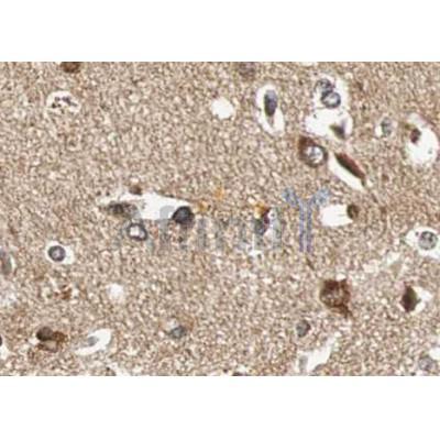 BDNF Antibody - DF6387 at 1/100 staining human brain tissue sections by IHC-P.