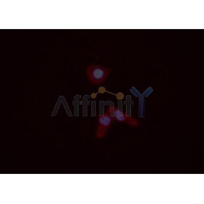 S100A4 Antibody - DF6516 staining A549 cells cells by ICC/IF.