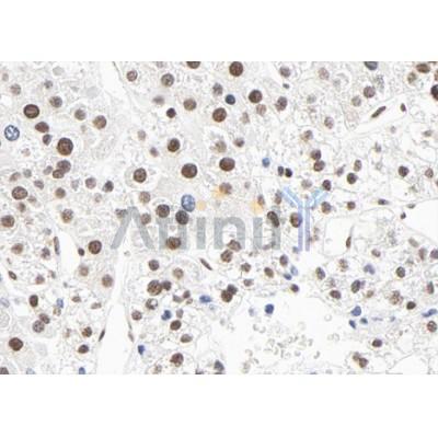 HNF4 alpha Antibody - DF6809 at 1/100 staining human liver tissue sections by IHC-P.