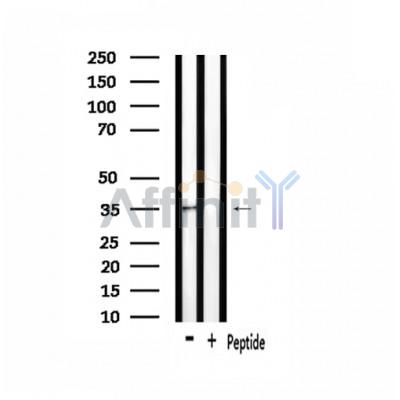 OR4F3/4F21 Antibody - Western blot analysis of extracts from rat brain, using OR4F3/4F21 Antibody.