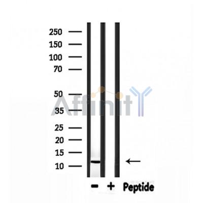Parvalbumin Antibody - Western blot analysis of extracts from rat muscle, using Parvalbumin Antibody.