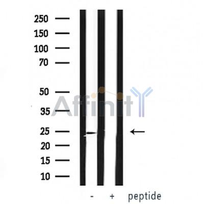 VHL Antibody - Western blot analysis of VHL expression in whole cell lysates,The lane on the left was treated with the antigen-specific peptide.