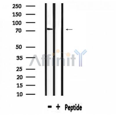 SLC6A8 Antibody - Western blot analysis of extracts from mouse  brain, using SLC6A8 Antibody.