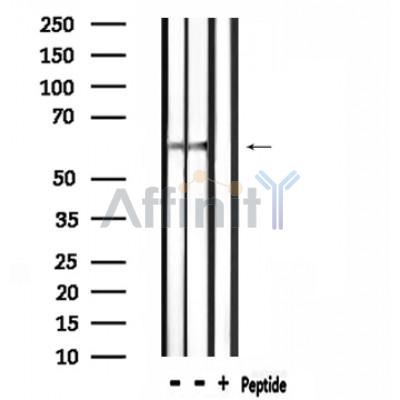 SLC9A8 Antibody - Western blot analysis of extracts from rat brain,rat spleen, using SLC9A8 Antibody.