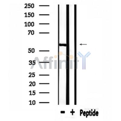 USP30 Antibody - Western blot analysis of extracts from rat brain, using USP30 Antibody.