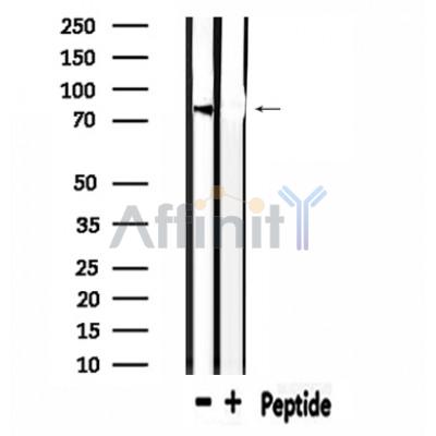 USP44 Antibody - Western blot analysis of extracts from mouse muscle, using USP44 Antibody.