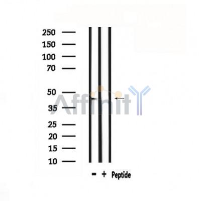 GATA6 Antibody - Western blot analysis of extracts from rat spleen, using GATA6 Antibody.