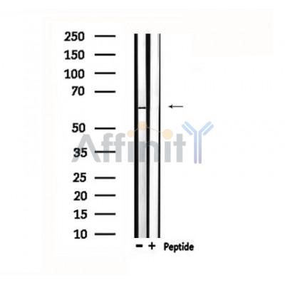 TESK2 Antibody - Western blot analysis of extracts from rat brain, using TESK2 Antibody.