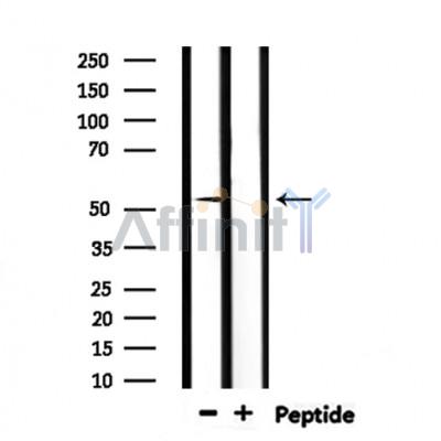 NR0B1 Antibody - Western blot analysis of extracts from rat liver, using NR0B1 Antibody.