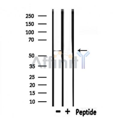 MMP10 Antibody - Western blot analysis of extracts from rat heart , using MMP10 Antibody.