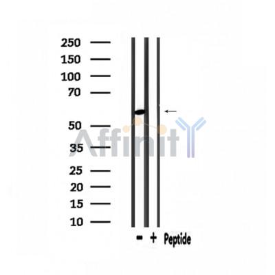 PDP2 Antibody - Western blot analysis of extracts from mouse brain, using PDP2 Antibody.