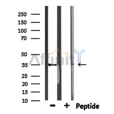 MAGEA12 Antibody - Western blot analysis of extracts from HepG2, using MAGAC Antibody.
