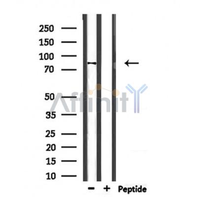 NEB2 Antibody - Western blot analysis of extracts from mouse heart, using NEB2 Antibody.