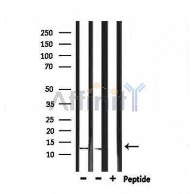 IGFL2 Antibody - Western blot analysis of extracts from rat kidney and mouse spleen, using IGFL2 Antibody.