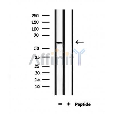 PCTK2 Antibody - Western blot analysis of extracts from mouse heart, using PCTK2 Antibody.
