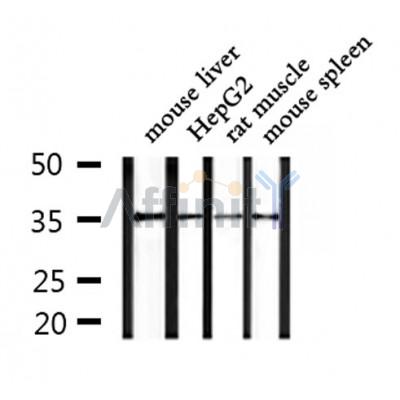 OR4F15 Antibody - Western blot analysis of extracts from mouse liver and HepG2 and rat muscle and mouse spleen, using OR4F15 Antibody.