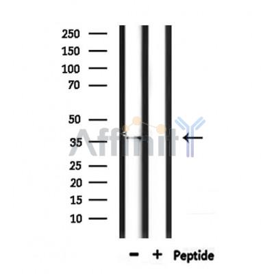 OR4D5 Antibody - Western blot analysis of extracts from mouse brain, using OR4D5 Antibody.