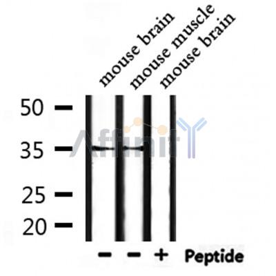 OR52P1 Antibody - Western blot analysis of extracts from mouse brain and mouse muscle, using OR52P1 Antibody.