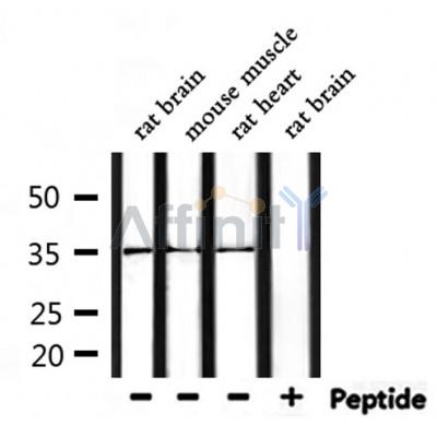 OR52R1 Antibody - Western blot analysis of extracts from mouse muscle and rat brain and rat heart, using OR52R1 Antibody.