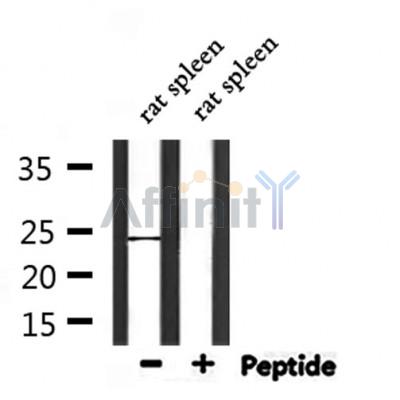 CD53 Antibody - Western blot analysis of extracts from rat spleen, using CD53 Antibody.
