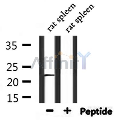 C56D2 Antibody - Western blot analysis of extracts from rat spleen, using C56D2 Antibody.