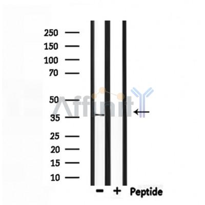 OR5V1 Antibody - Western blot analysis of extracts from rat muscle, using OR5V1 Antibody.