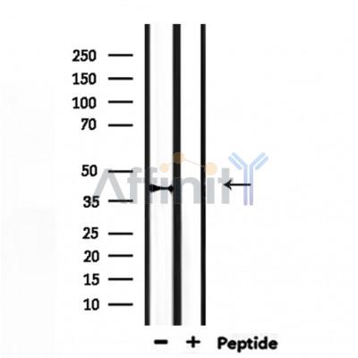 Cytochrome P450 27C1 Antibody - Western blot analysis of extracts from rat muscle, using Cytochrome P450 27C1 Antibody.