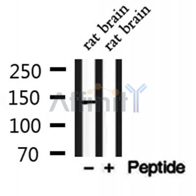 CADPS2 Antibody - Western blot analysis of extracts from rat brain, using CADPS2 Antibody.