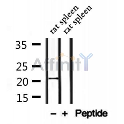 CTAG2 Antibody - Western blot analysis of extracts from rat spleen, using CTAG2 Antibody.