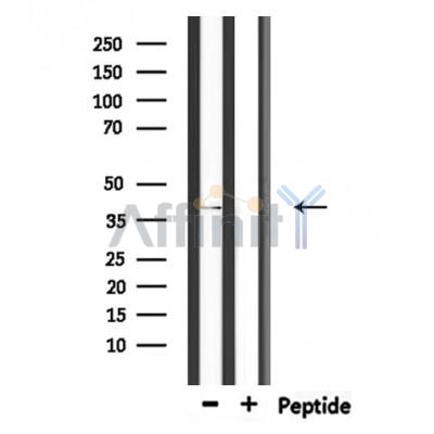 CHST11 Antibody - Western blot analysis of extracts from rat spleen, using CHST11 Antibody.