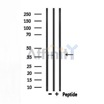 RNF41 Antibody - Western blot analysis of extracts from rat muscle, using RNF41 Antibody.