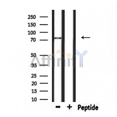 PJA1 Antibody - Western blot analysis of extracts from rat brain, using PJA1 Antibody.