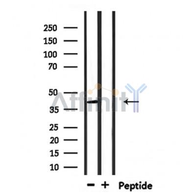 RNF167 Antibody - Western blot analysis of extracts from mouse brain, using RNF167 Antibody.