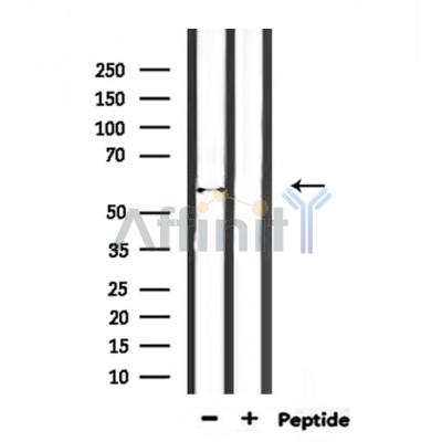 ENDOD1 Antibody - Western blot analysis of extracts from rat muscle, using ENDOD1 Antibody.