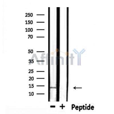 MSS4 Antibody - Western blot analysis of extracts from mouse kidney, using MSS4 Antibody.