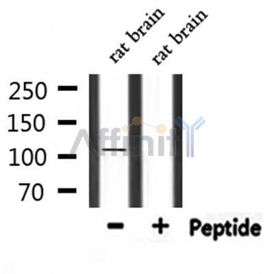MYO1A Antibody - Western blot analysis of extracts from rat brain, using MYO1A Antibody.