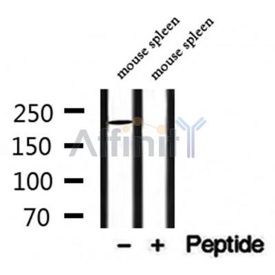 MYO16 Antibody - Western blot analysis of extracts from mouse spleen, using MYO16 Antibody.