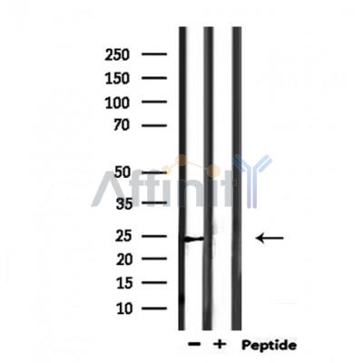 SCG5 Antibody - Western blot analysis of extracts from mouse muscle, using SCG5 Antibody.