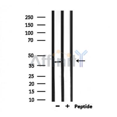 NEUROD4 Antibody - Western blot analysis of extracts from mouse muscle, using NEUROD4 Antibody.
