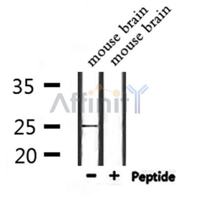 NOL12 Antibody - Western blot analysis of extracts from mouse brain, using NOL12 Antibody.