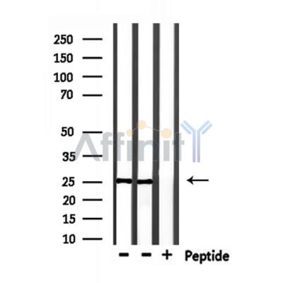 RAB28 Antibody - Western blot analysis of extracts from mouse heart and rat spleen, using RAB28 Antibody.