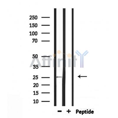 RAB32 Antibody - Western blot analysis of extracts from mouse kidney, using RAB32 Antibody.