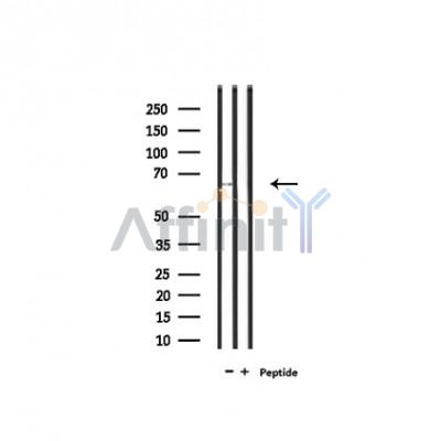 SLC6A20 Antibody - Western blot analysis of extracts from rat liver, using SLC6A20 Antibody.