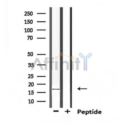 TRAPPC1 Antibody - Western blot analysis of extracts from mouse brain, using TRAPPC1 Antibody.