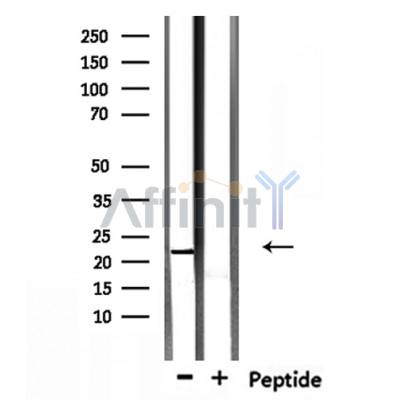 TCEAL5 Antibody - Western blot analysis of extracts from mouse brain, using TCEAL5 Antibody.